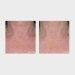 MyBody Neck-Cessity before and after